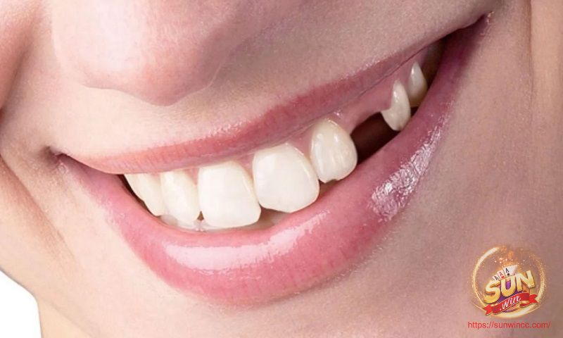 Mơ nhổ răng phải nhập viện liên quan đến sức khỏe